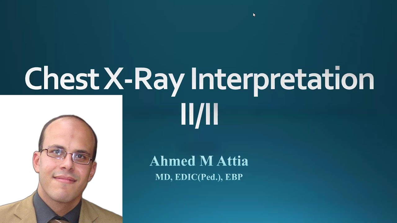 Chest x-ray interpretation for young pediatrician  part 2 Dr Ahmed Attia