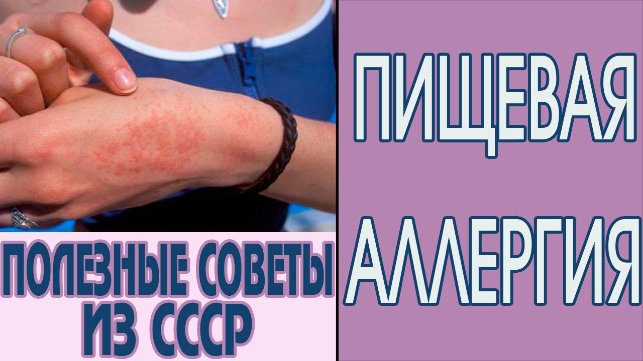 Пищевая аллергия у взрослых. Пищевая непереносимость. Как лечить ...