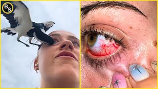 Dangerous! This Woman's Eye Got Pecked by Magpie by Ben Sojo 28,123 views 5 months ago 2 minutes, 38 seconds