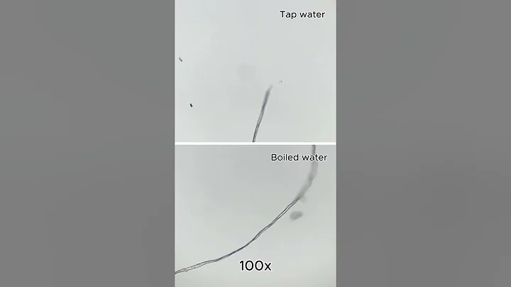 Tap water vs Boiled water under a microscope!