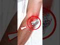 The Itch You Can’t Escape: The Truth About Psoriasis #psoriasis #skindiseases #psoriasisawareness