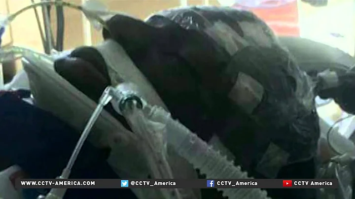 Baltimore protesters demand answers in death of 25-year-old