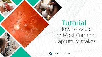 Eyer Tutorial - How to Avoid the Most Common Capture Mistakes