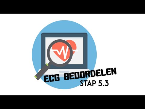 ECG beoordelen - stap 5.3 (QRS-morfologie)(Pathologisch Q & Hypertrofie)