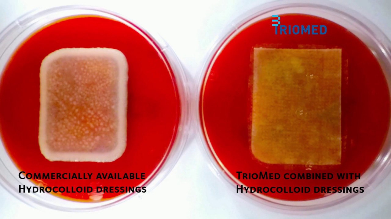 TrioMed VS Hydrocolloid