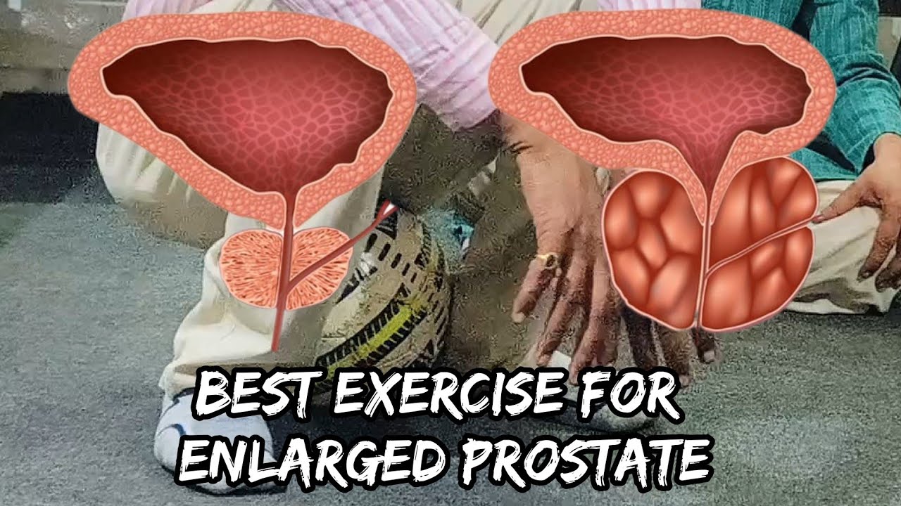 Fix enlarged prostate by sitting on the ball !! Best exercise for ...