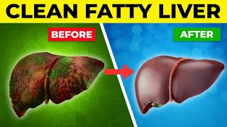 7 FOODS that CLEAN Fatty Liver by Heart Disease Code 54,390 views 5 months ago 16 minutes