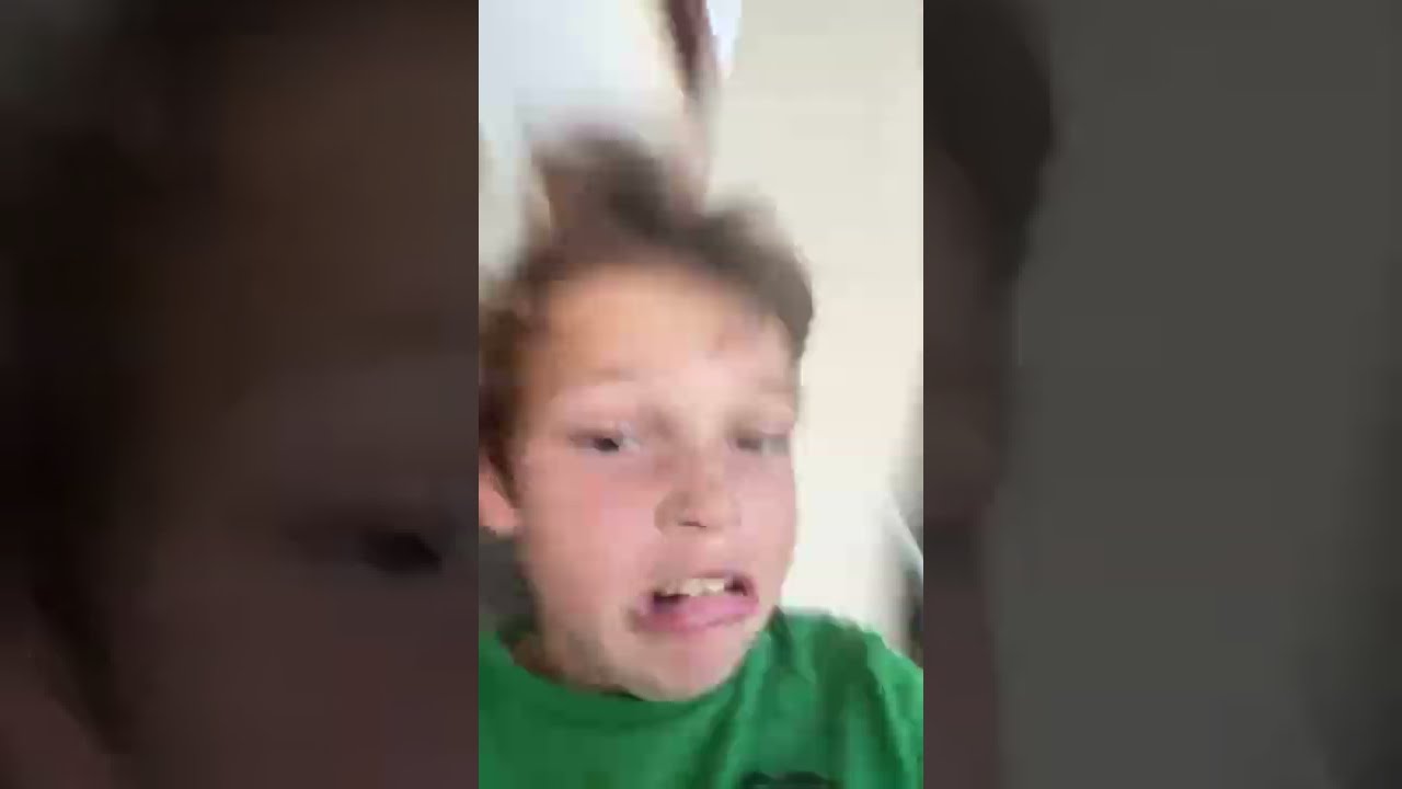 I Cracked My Head Open 
