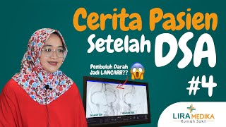 CERITA PASIEN VERTIGO & MIGRAIN BERTAHUN-TAHUN | SETELAH TINDAKAN DSA PEMBULUH DARAH JADI LANCAR ???