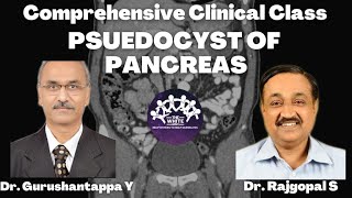 PSEUDOCYST OF PANCREAS Clinical case presentation