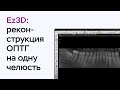 Возможности программы Ez3D: реконструкция ОПТГ на одну челюсть