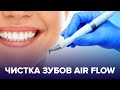 Профессиональная чистка зубов AIR FLOW - делать или нет?