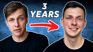 How my face has changed over 3 years