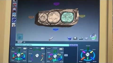 E4D Crown Technology