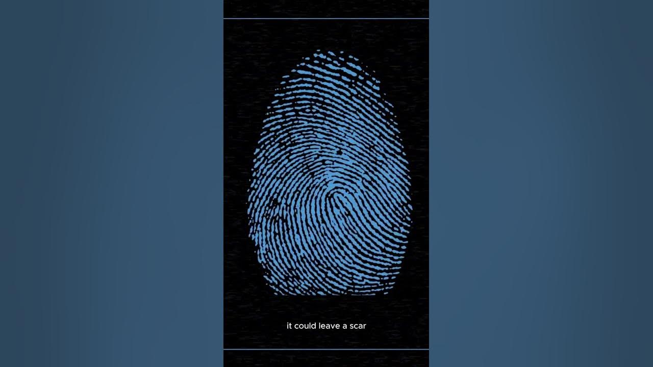 do-damaged-fingerprints-grow-back-the-same-youtube