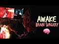 Awake surgery - Brain tumour