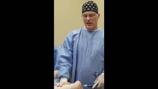 Calf Liposuction at Laser Lipo and Vein Center