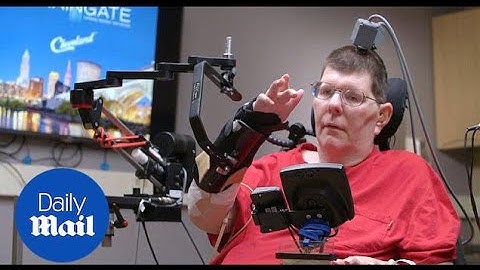 Medical breakthrough enables a paraylsed man to move his arms - Daily Mail