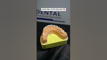 Labo đợi cuộc gọi từ các bác nhé 🥰🫶🏻 #răngsứ #laborangsu #implant #uytinchatluong