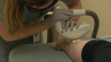 New treatment in Springfield that fixes scar tissue with lasers