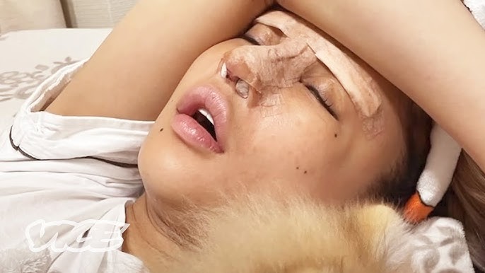 Unlicensed Doctors Botched My Face - YouTube