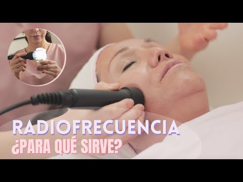 TODO SOBRE LA