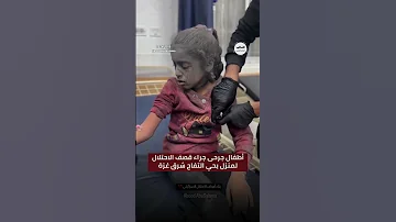 شاهد شهداء وجرحى معظمهم من الأطفال جراء قصف الاحتلال في حي التفاح شرق غزة 