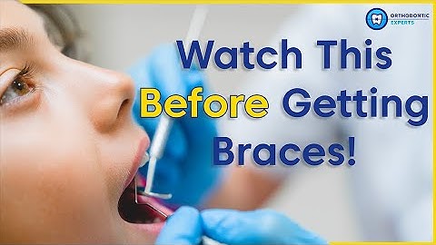What To Know Before Getting Braces | 8 Tips To Prepare You For Braces