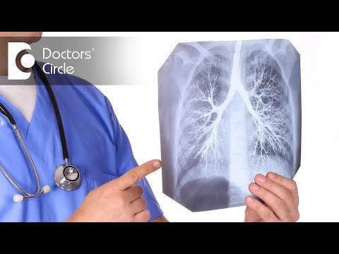 Video: Bronchitis Is Contagious Or Not For Others: How Is It Transmitted