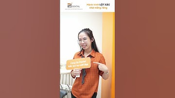 Hành trình LỘT XÁC nhờ niềng răng của Uyển Nhi