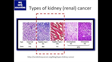 Rare Cancer Meta-Analysis, pt.1: Background on papillary renal cell carcinoma