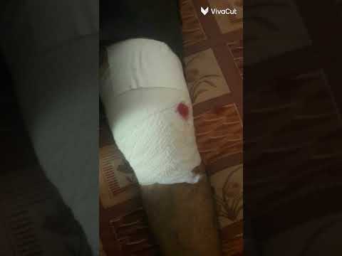 الف سلامة عليك