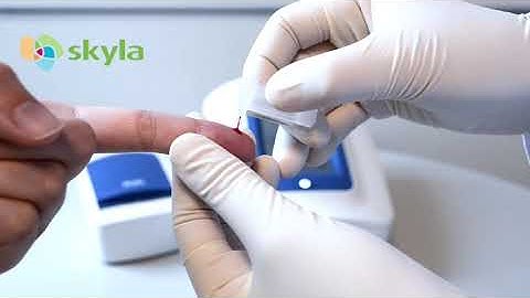 CRP test on skyla® Hi Analyzer. Chirus Limited