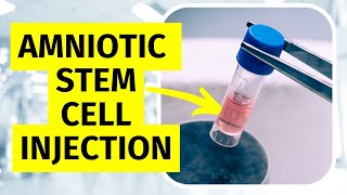 I Review Amniotic Stem Cell Therapy for Knee Arthritis
