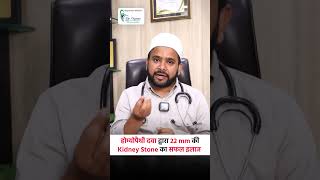 22mm Kidney Stone Treatment Without Surgery | Homeopathy Cure | Dr Nazar Kanpur | 9112518736
