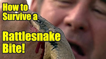 How To Survive A Rattlesnake Bite