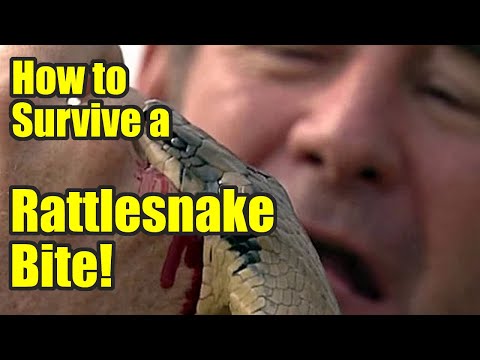 How To Survive A Rattlesnake Bite This