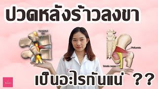 ปวดหลังร้าวลงขา เกิดอะไรขึ้นกับเรา by รีบาลานซ์ คลินิกกายภาพบำบัด