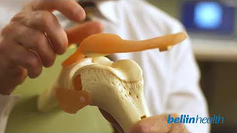 Patellofemoral Pain Syndrome