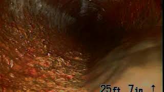 VIDEO059
