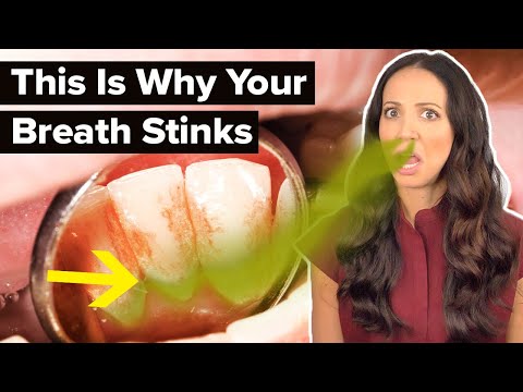 Video: Vai dobums var izraisīt sliktu elpu?