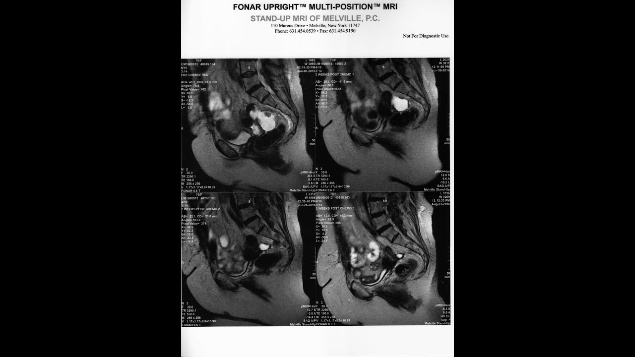 The MRI Experiments - Part 2