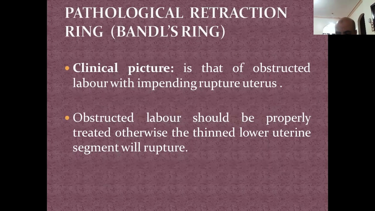 Pin by شفق on Gynae/Obs | Obstetrics and gynaecology, Obstetrics, Medical  terminology