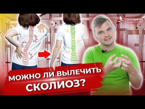 Можно ли вылечить сколиоз?