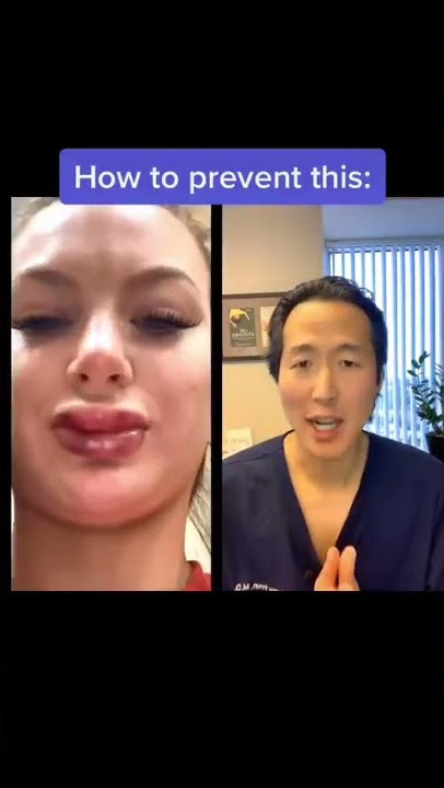 Doctor Reacts to Lip Plumping Injections! #shorts #lipinjections