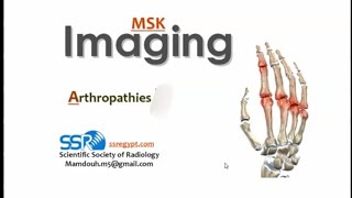 Imaging of polyarthropathies (II) (DRE) Prof. Mamdouh Mahfouz screenshot 5