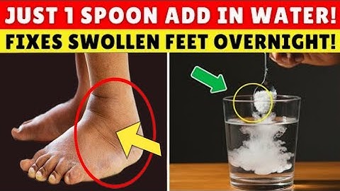 9 Bedtime Fixes That Drain Foot Swelling | Seniors Over 50 Must Try This! | Senior Health Tips