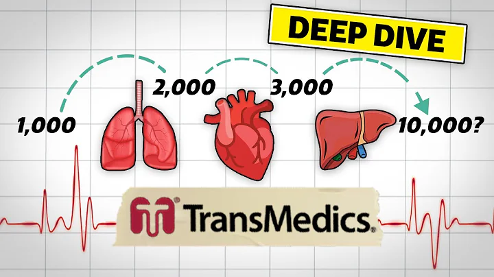 Transmedics Stock Deep Dive: The Path to 10,000 Transplants
