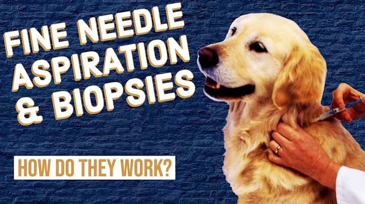 Fine-Needle Aspiration & Biopsies