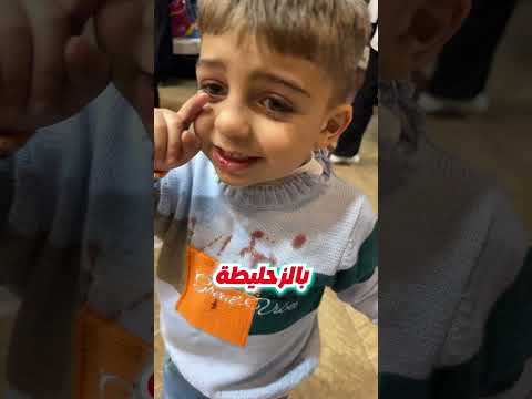 ميدو وقع و نجرح تمه في الالعاب بيسو